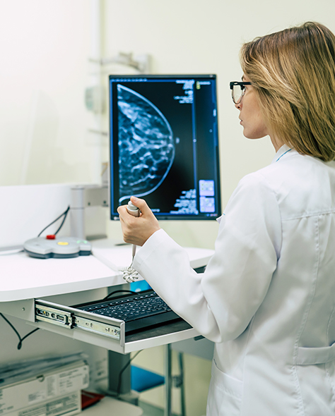 doctora con imagen de mamografía